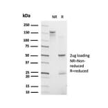 SDS-PAGE - Anti-CHRAC17 Antibody [PCRP-POLE3-3D3] (A277753) - Antibodies.com