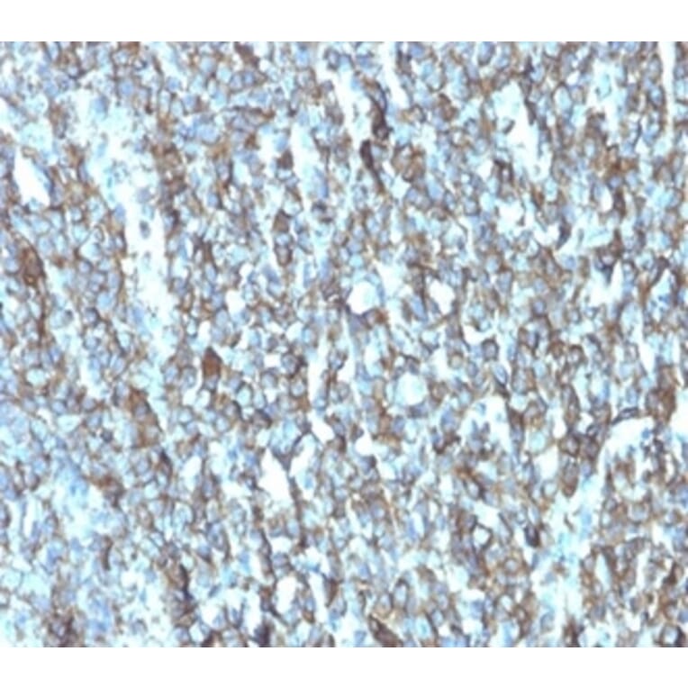 Immunohistochemistry - Anti-Migfilin Antibody [FBLIM1/4600] (A277758) - Antibodies.com