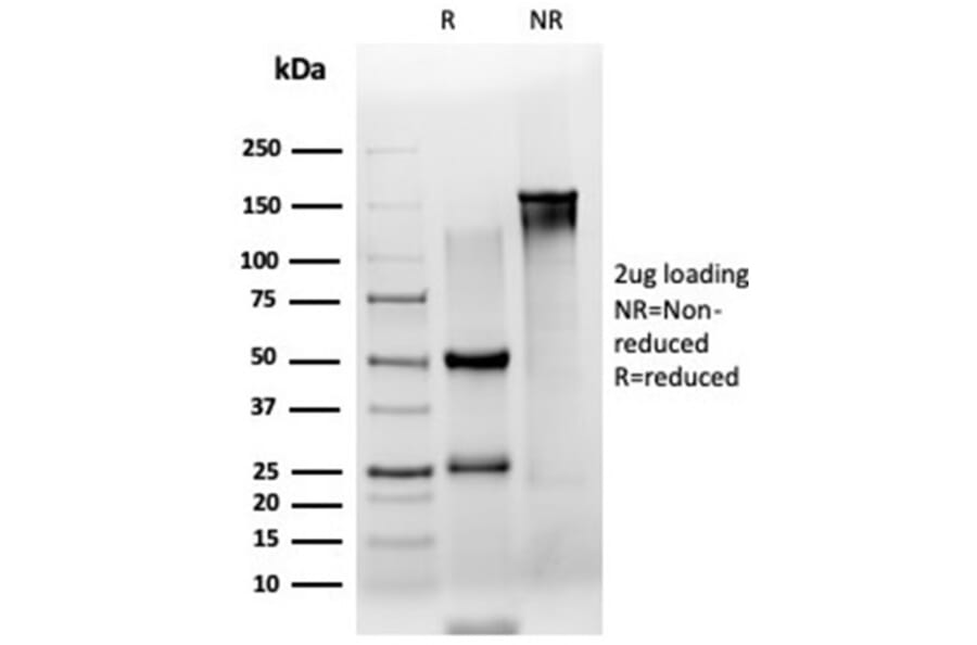 SDS-PAGE - Anti-ZSCAN2 Antibody [PCRP-ZSCAN2-1F8] (A277760) - Antibodies.com