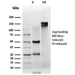 SDS-PAGE - Anti-ZSCAN2 Antibody [PCRP-ZSCAN2-1F8] (A277760) - Antibodies.com