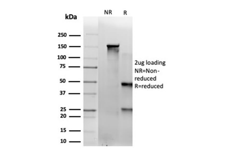 SDS-PAGE - Anti-SAMD4B Antibody [PCRP-SAMD4B-1H3] (A277761) - Antibodies.com