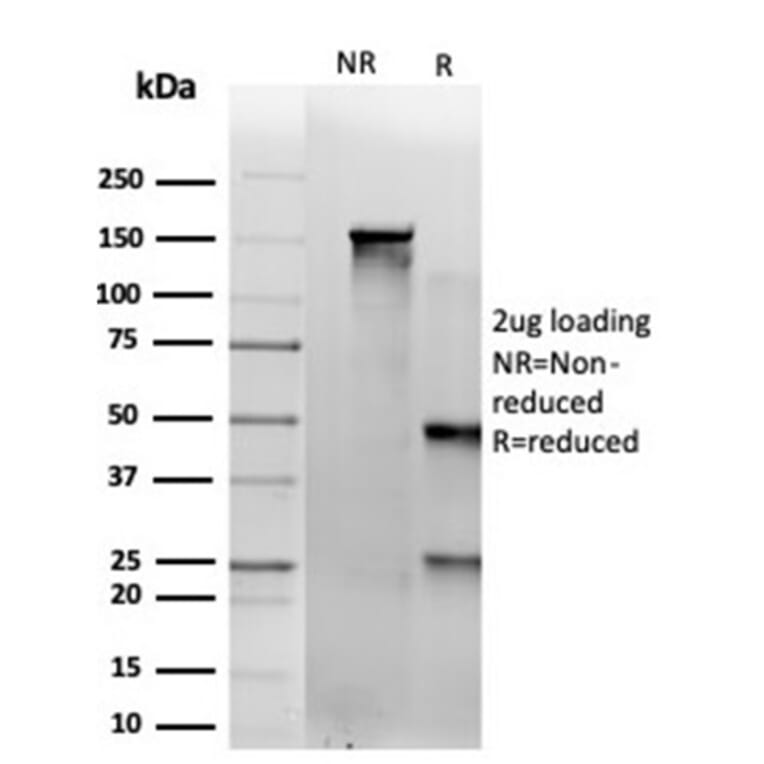 SDS-PAGE - Anti-SAMD4B Antibody [PCRP-SAMD4B-1H3] (A277761) - Antibodies.com