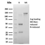 SDS-PAGE - Anti-PHF10 Antibody [PCRP-PHF10-2A10] (A277762) - Antibodies.com