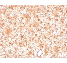 Immunohistochemistry - Anti-PKC iota Antibody [PRKCI/4911] (A277763) - Antibodies.com