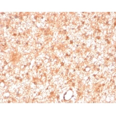 Immunohistochemistry - Anti-PKC iota Antibody [PRKCI/4911] (A277763) - Antibodies.com