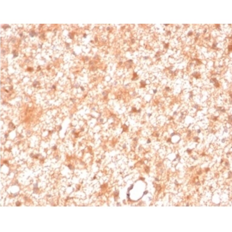 Immunohistochemistry - Anti-PKC iota Antibody [PRKCI/4911] (A277763) - Antibodies.com