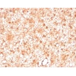 Immunohistochemistry - Anti-PKC iota Antibody [PRKCI/4911] (A277763) - Antibodies.com