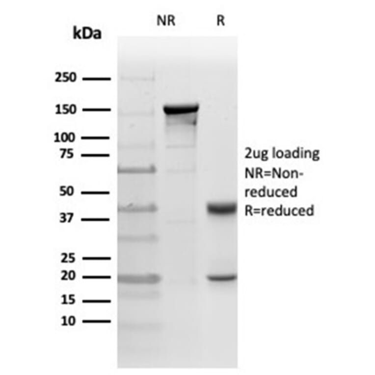 Immunohistochemistry - Anti-PKC iota Antibody [PRKCI/4911] (A277763) - Antibodies.com