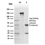 Immunohistochemistry - Anti-PKC iota Antibody [PRKCI/4911] (A277763) - Antibodies.com