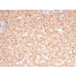 SDS-PAGE - Anti-PKC iota Antibody [PRKCI/4911] (A277763) - Antibodies.com