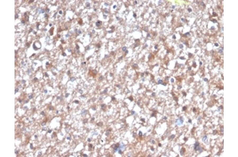 Immunohistochemistry - Anti-PKC iota Antibody [PRKCI/4912] (A277764) - Antibodies.com