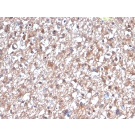 Immunohistochemistry - Anti-PKC iota Antibody [PRKCI/4912] (A277764) - Antibodies.com