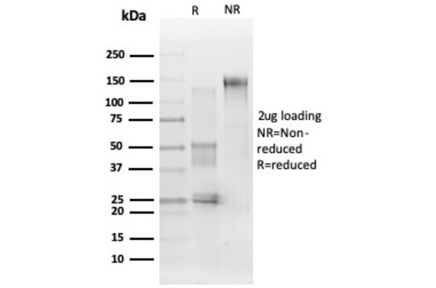 SDS-PAGE - Anti-ERK2 Antibody [PCRP-MAPK1-1D1] (A277765) - Antibodies.com