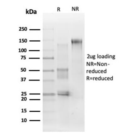 SDS-PAGE - Anti-ERK2 Antibody [PCRP-MAPK1-1D1] (A277765) - Antibodies.com