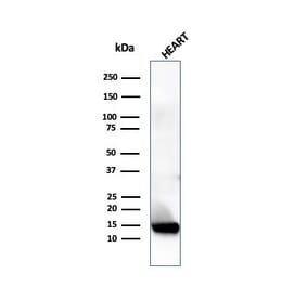 Western Blot - Anti-Resistin Antibody [RETN/4324] (A277767) - Antibodies.com