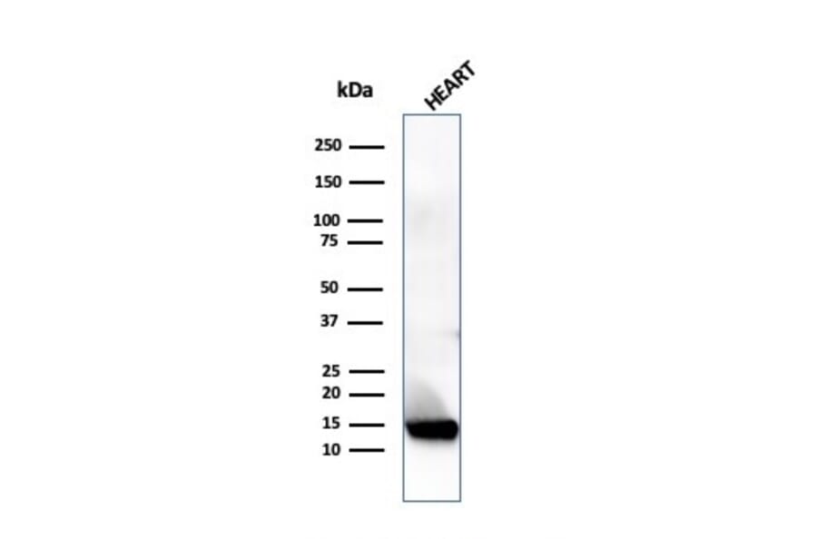 Western Blot - Anti-Resistin Antibody [RETN/4324] (A277767) - Antibodies.com