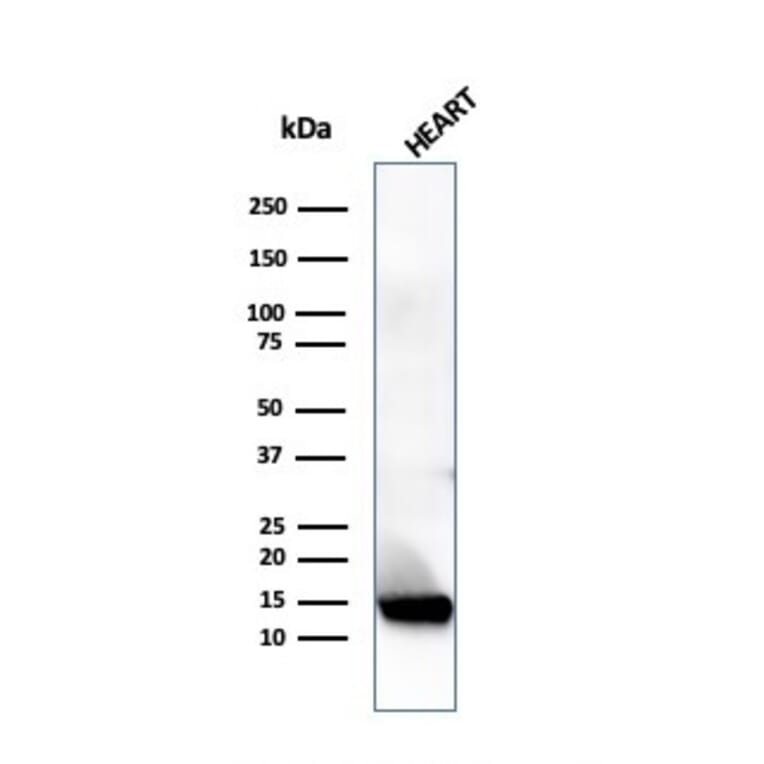 Western Blot - Anti-Resistin Antibody [RETN/4324] (A277767) - Antibodies.com