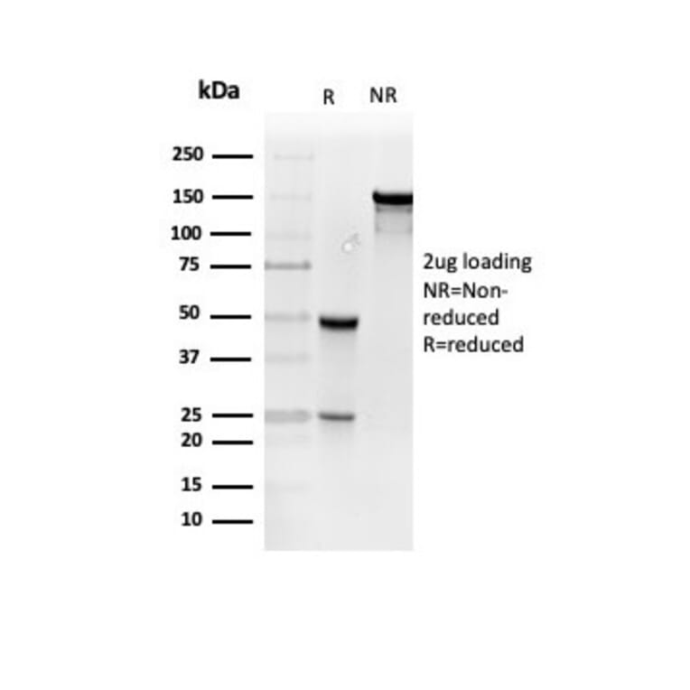 SDS-PAGE - Anti-Resistin Antibody [RETN/4327] (A277768) - Antibodies.com