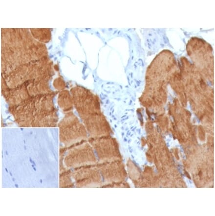 Immunohistochemistry - Anti-alpha Skeletal Muscle Actin Antibody [ACTA1/360] (A277770) - Antibodies.com