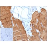 Immunohistochemistry - Anti-alpha Skeletal Muscle Actin Antibody [ACTA1/360] (A277770) - Antibodies.com