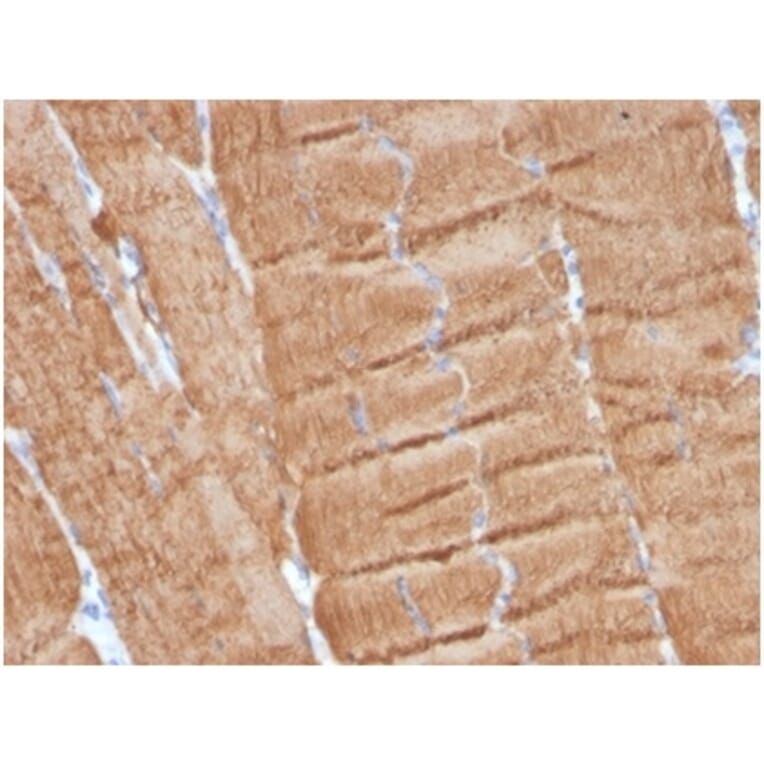 Immunohistochemistry - Anti-alpha Skeletal Muscle Actin Antibody [ACTA1/360] (A277770) - Antibodies.com