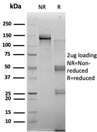 SDS-PAGE analysis of Anti-RBMS2 Antibody [PCRP-RBMS2-1B6] under non-reduced and reduced conditions; showing intact IgG and intact heavy and light chains, respectively. SDS-PAGE analysis confirms the integrity and purity of the antibody.