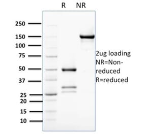 SDS-PAGE - Anti-Bcl2L2 Antibody [PCRP-BCL2L2-1A4] (A277772) - Antibodies.com