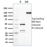 SDS-PAGE - Anti-Bcl2L2 Antibody [PCRP-BCL2L2-1A4] (A277772) - Antibodies.com