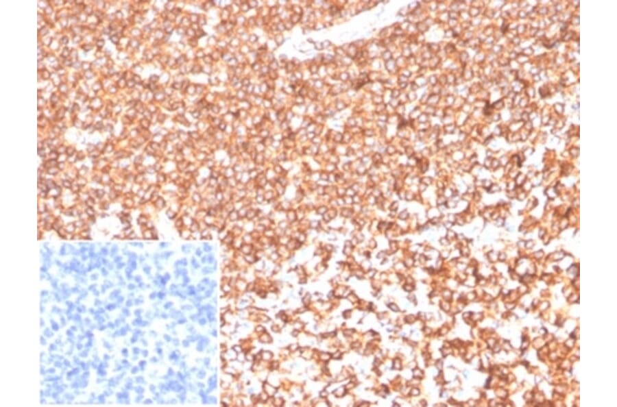 Immunohistochemistry - Anti-beta Actin Antibody [ACTB/1108] (A277773) - Antibodies.com