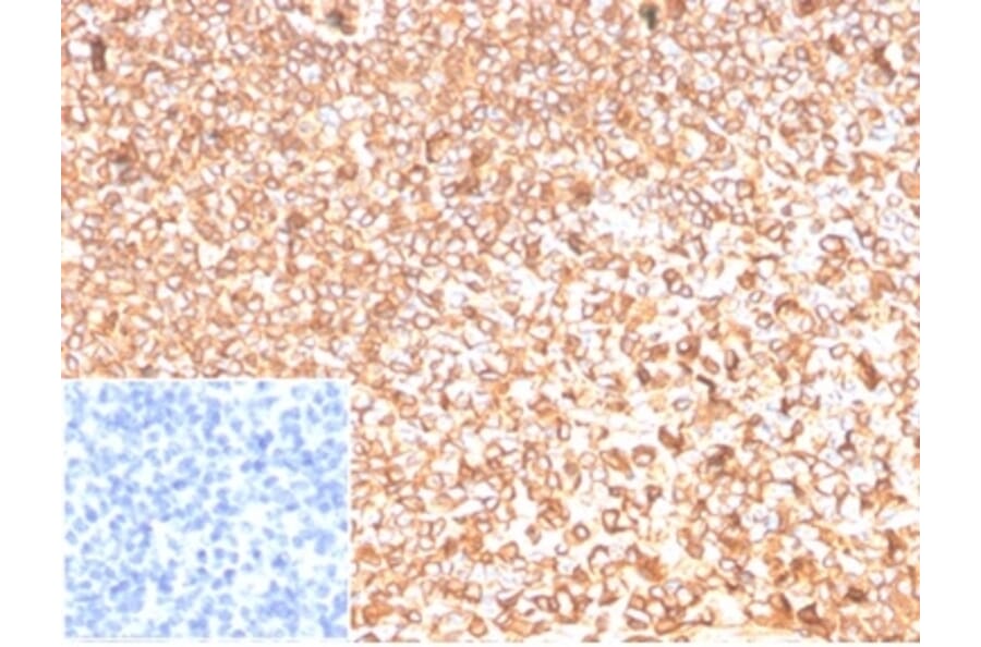Immunohistochemistry - Anti-beta Actin Antibody [ACTB/1109] (A277774) - Antibodies.com