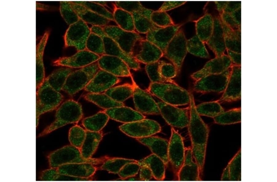 Immunofluorescence - Anti-Bcl-6 Antibody [PCRP-BCL6-1E2] (A277776) - Antibodies.com