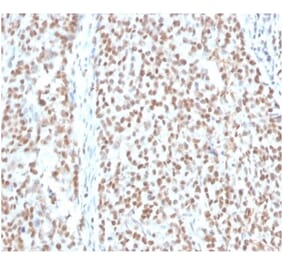 Immunohistochemistry - Anti-RPA2 Antibody [RPA2/4774] (A277777) - Antibodies.com