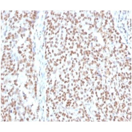 Immunohistochemistry - Anti-RPA2 Antibody [RPA2/4774] (A277777) - Antibodies.com