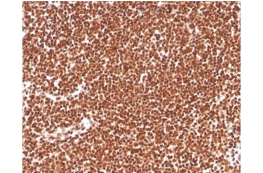 Immunohistochemistry - Anti-RPA2 Antibody [RPA2/4774] (A277777) - Antibodies.com