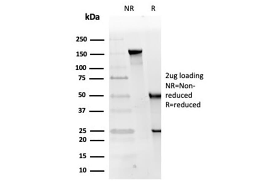 SDS-PAGE - Anti-RPA2 Antibody [RPA2/4774] (A277777) - Antibodies.com