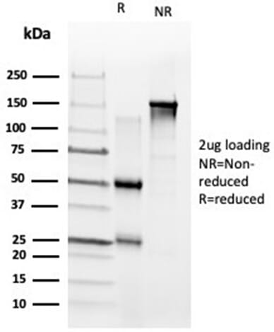 SDS-PAGE analysis of Anti-ZNF704 Antibody [PCRP-ZNF704-3C10] under non-reduced and reduced conditions; showing intact IgG and intact heavy and light chains, respectively. SDS-PAGE analysis confirms the integrity and purity of the antibody.