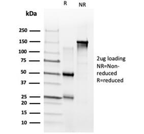 SDS-PAGE - Anti-ZNF704 Antibody [PCRP-ZNF704-3C10] (A277778) - Antibodies.com
