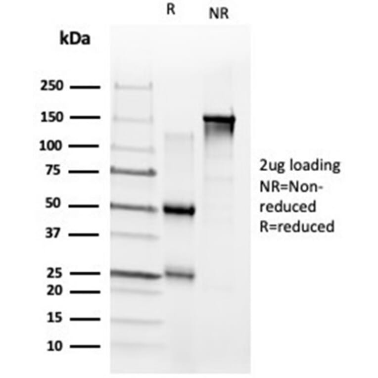SDS-PAGE - Anti-ZNF704 Antibody [PCRP-ZNF704-3C10] (A277778) - Antibodies.com