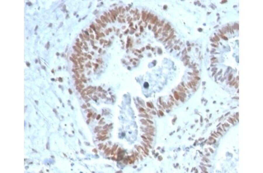 Immunohistochemistry - Anti-ZNF704 Antibody [PCRP-ZNF704-3C10] (A277778) - Antibodies.com