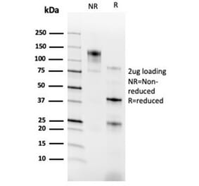 SDS-PAGE - Anti-RXRG Antibody [PCRP-RXRG-5H4] (A277780) - Antibodies.com