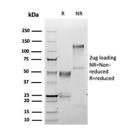 SDS-PAGE - Anti-S100A1 Antibody [S100A1/6374R] (A277781) - Antibodies.com