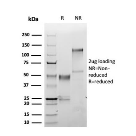 SDS-PAGE - Anti-S100A1 Antibody [S100A1/6374R] (A277781) - Antibodies.com