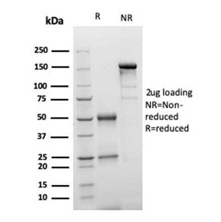 SDS-PAGE - Anti-S100 beta Antibody [S100B/4149] (A277782) - Antibodies.com