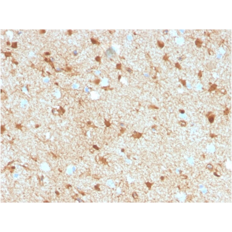 Immunohistochemistry - Anti-S100 beta Antibody [S100B/4149] (A277782) - Antibodies.com