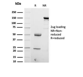 SDS-PAGE - Anti-S100 beta Antibody [S100B/4153] (A277783) - Antibodies.com