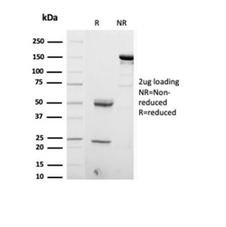 SDS-PAGE - Anti-S100 beta Antibody [S100B/4153] (A277783) - Antibodies.com