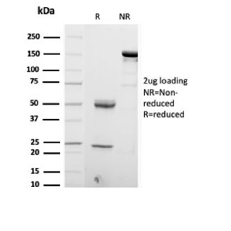 SDS-PAGE - Anti-S100 beta Antibody [S100B/4153] (A277783) - Antibodies.com