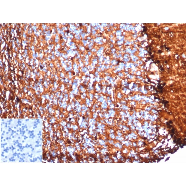 Immunohistochemistry - Anti-S100 beta Antibody [S100B/4153] (A277783) - Antibodies.com