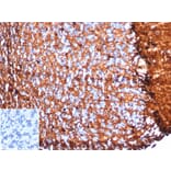 Immunohistochemistry - Anti-S100 beta Antibody [S100B/4153] (A277783) - Antibodies.com