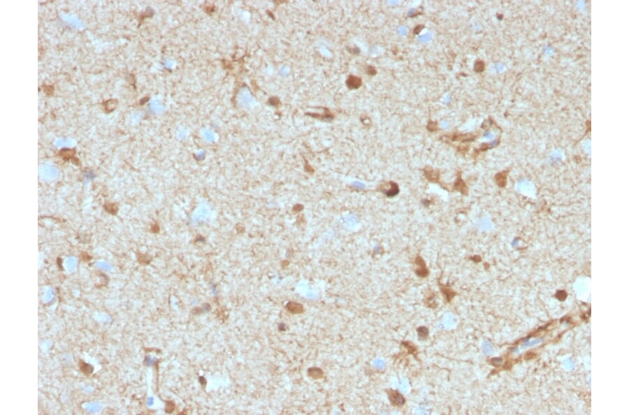 Immunohistochemistry - Anti-S100 beta Antibody [S100B/4153] (A277783) - Antibodies.com